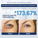 Kräm mot påsar - 💖Köp 1, få 1 gratis (2 st)💖