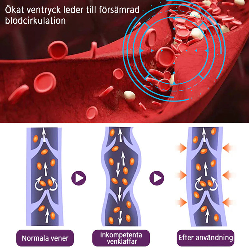 Polidocanol Nano Åderbråcksplåster