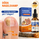 Nagelvårdslösning