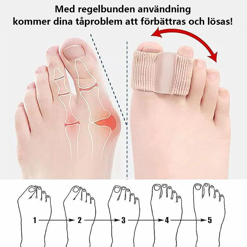 Tåseparator för korrigering av hallux valgus