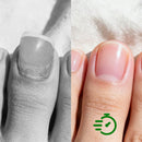 Svampdödande nagellösning