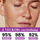 Advanced Anti-hyperpigmenteringsessens