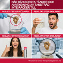 Kraftfullt fläckborttagande munskölj – Ljusare tänder med varje sköljning