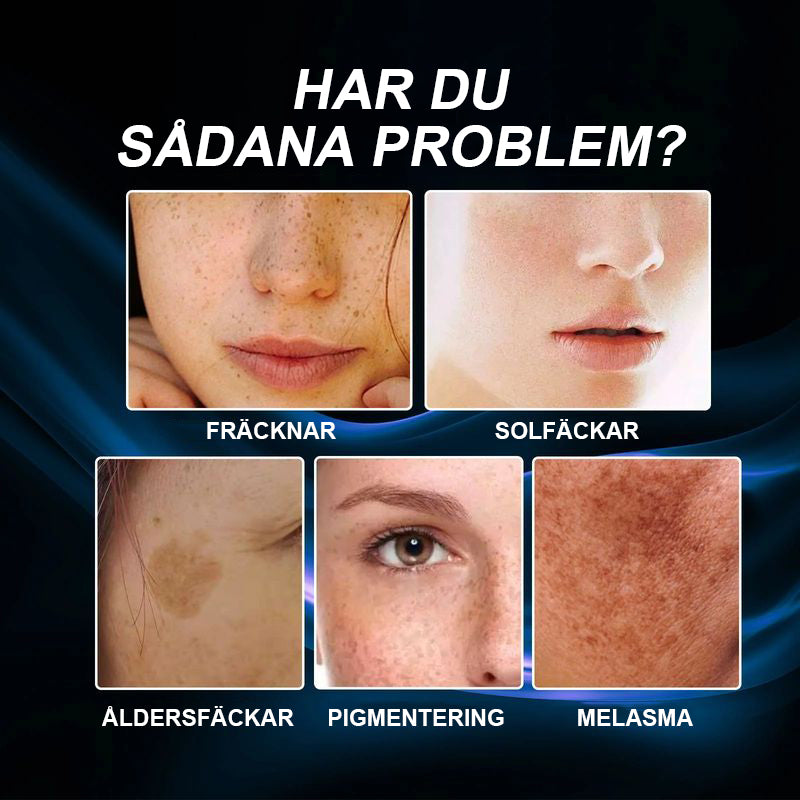 C-vitaminvitgörande och anti-fräknande kräm
