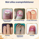 Keratin nagelreparationsserum