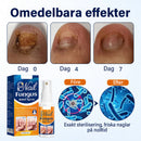 Lugnande nagelspray