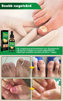 Nagelvård med ingefära