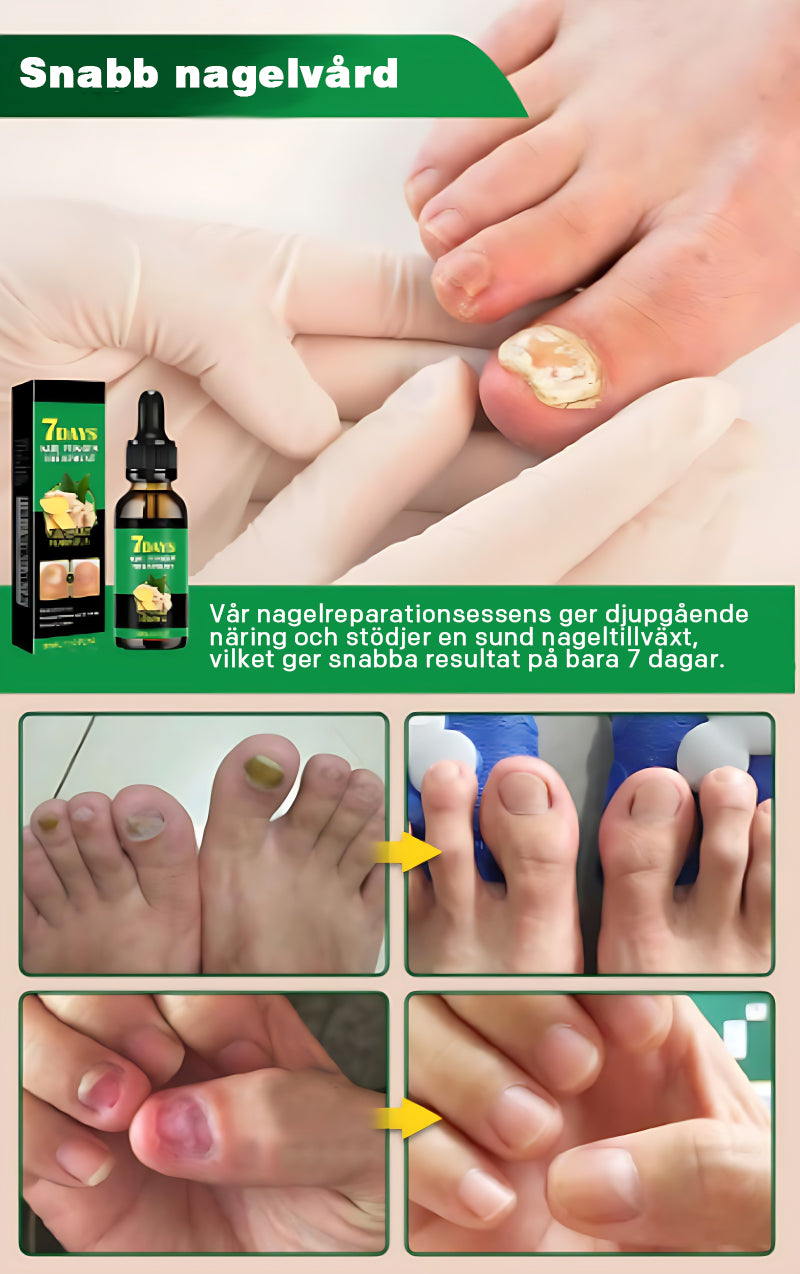 Nagelvård med ingefära