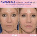 Osynlig tejp för V-ansiktslyftning-Köp 1 få 1 gratis (2 förpackningar)