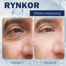 Kräm mot påsar - 💖Köp 1, få 1 gratis (2 st)💖