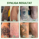 Bläckborttagningsspray — Säg adjö till gamla tatueringspigment och bleknar envist bläck.