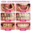 Gel För Munvård