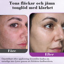 Advanced Anti-hyperpigmenteringsessens