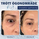 Kräm mot påsar - 💖Köp 1, få 1 gratis (2 st)💖