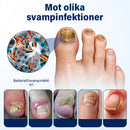 Lugnande nagelspray
