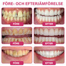 Gel För Munvård