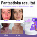 Violett eksembehandlingskräm