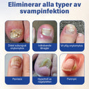 Nagelvårdslösning