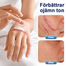 Texturreparerande gel