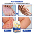 Bivänspray mot psoriasis