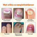Avancerad nagelreparationsspray