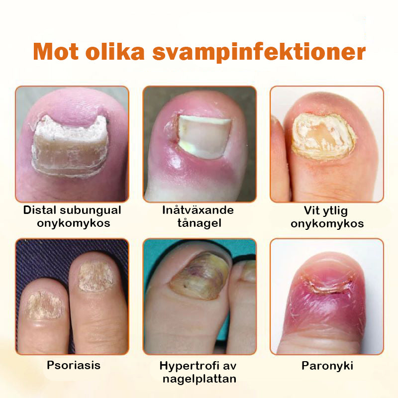 Avancerad nagelreparationsspray