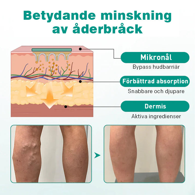 Venförhöjd topisk plåster