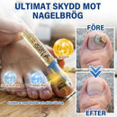 Lösning för nagelvård med bigift