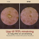 Mild exfolierande essens