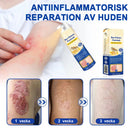 Bivänspray mot psoriasis