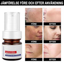 C-vitaminvitgörande och anti-fräknande kräm