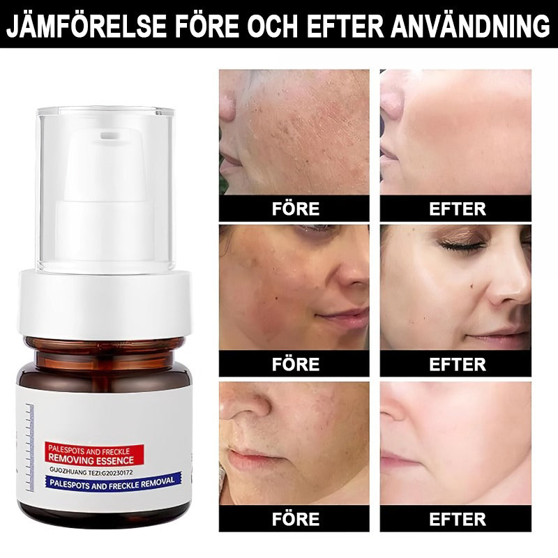 C-vitaminvitgörande och anti-fräknande kräm