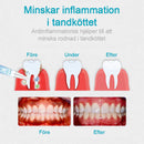 Gel för tandköttsterapi-Köp 1 och få 1 gratis (2 ST)