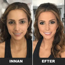 Tre-tonig hyklorekorrigerare