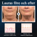 Skönhetsenhet för sovande V-ansikte