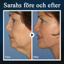 Skönhetsenhet för sovande V-ansikte