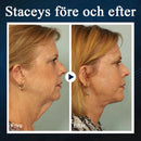 Skönhetsenhet för sovande V-ansikte