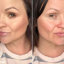 Tre-tonig hyklorekorrigerare